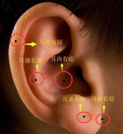 左耳痣|耳朵长痣的位置图解 耳朵长痣的位置图解有福气